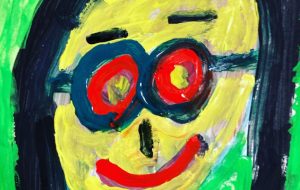 整形ミスったユミタン - 笹谷正博