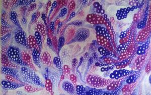 生まれ、そして消えていく、心の病巣。 - Yuri Kawashima - 川島ゆり