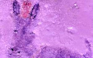 ブレちゃん - 久保田 俊