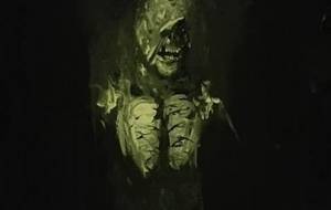 肺癌悲しみの後光 - 真鍋哲地