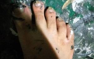 ゴミ虫の足 - 真鍋哲地 