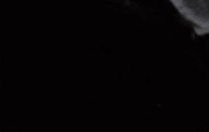 眼球のあばら骨 - 真鍋哲地