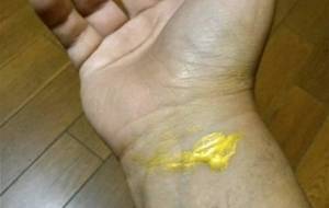 ボディインスタレーション黄金の傷口 - 真鍋哲地