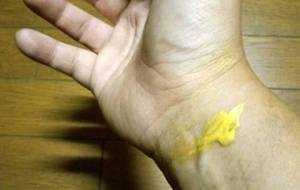 インスタレーション精神の傷口 - 真鍋哲地