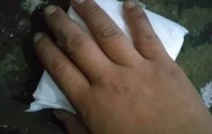 尿漏れパッド愛のごみ - 真鍋哲地