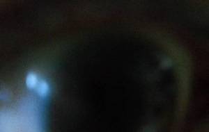 インスタレーシヨン愛体、眼球 - 真鍋哲地