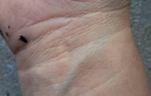 血管、母さんがくれたこの身体、ありがとう - 真鍋哲地