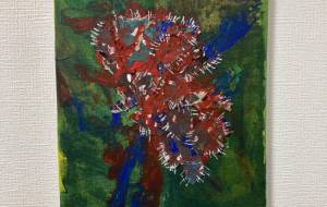 きりきりいたい。 - nmbart