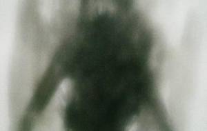 雨降り笑い者の蛙みたいに、幻聴が僕を笑う - 真鍋哲地