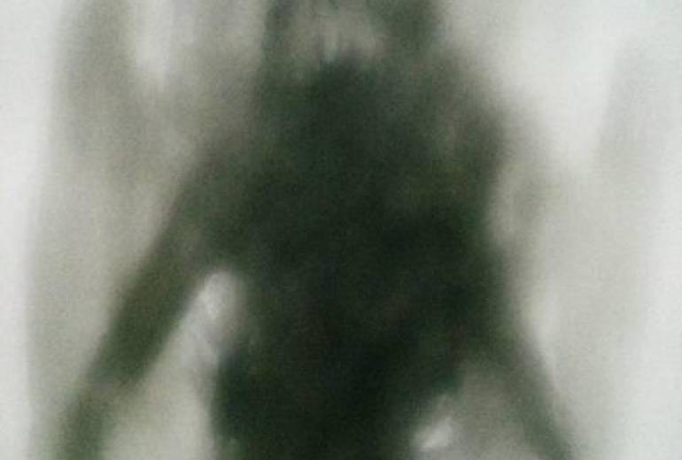 雨降り笑い者の蛙みたいに、幻聴が僕を笑う