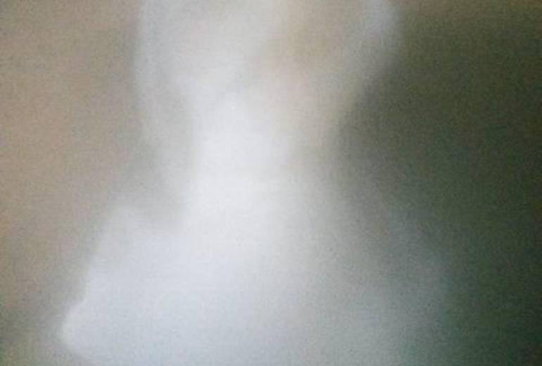 残酷、残酷、残酷、てるてる坊主貧困