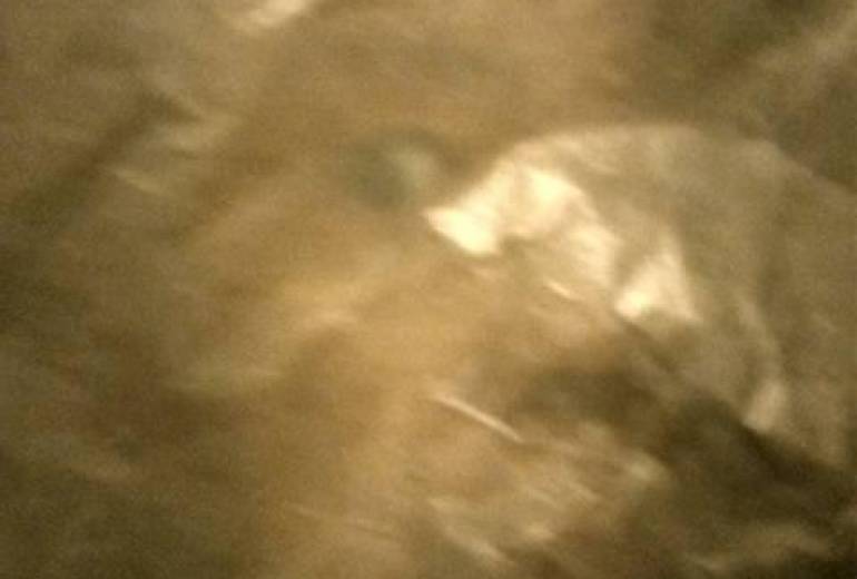 精神障害、陽運命（思い思い）