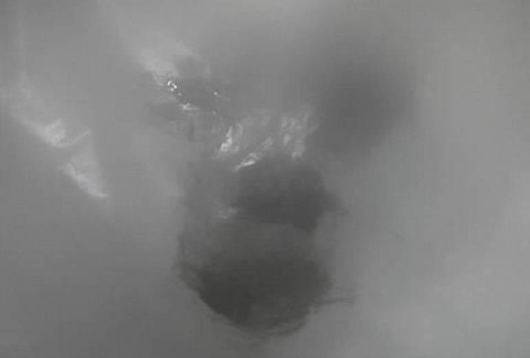 涙癌（慈悲を）祖父