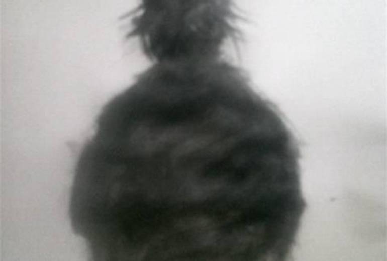 貴方はハンセン病かもしれない（でも僕は言う貴方達を愛してると）