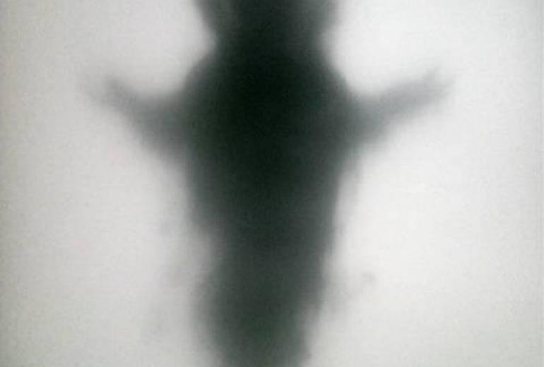 精神障がい（小人症候群）障害者特殊能力（神妄想）