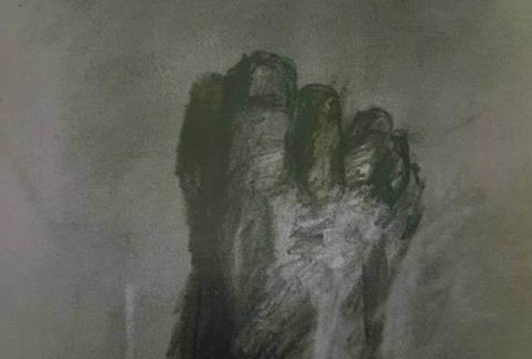 精神障がい者被害妄想の足