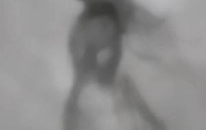 彼女は美しい障がい者の女性、でも彼女が愛した人は健常者の男性(叶わぬ恋なのか) - 真鍋哲地