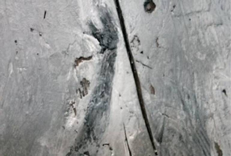 どんなに思っても、、（愛し合うことがタブーな精神障害者の愛）