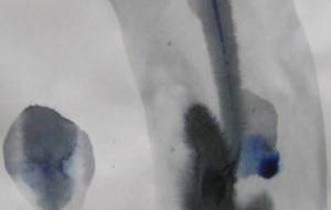 染み-13 - 沖 弘康