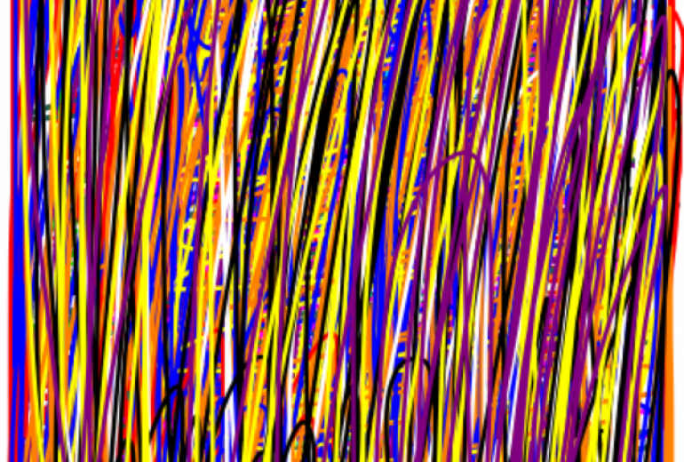 アール・ブリュット挑戦