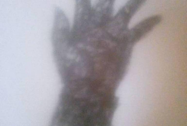 傷だらけの戦火兵士、彼らは生きてるんだ