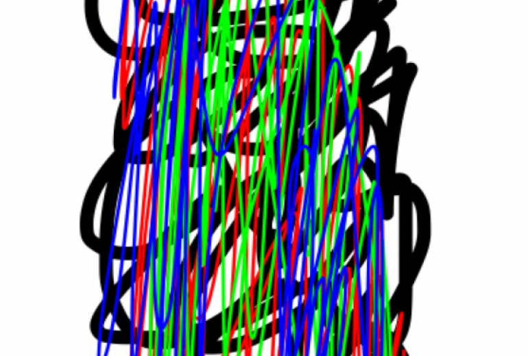 アール・ブリュット挑戦