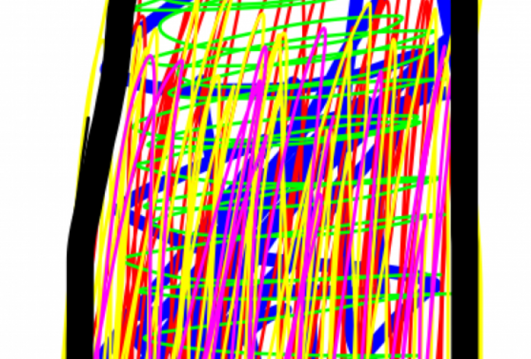 アール・ブリュット挑戦