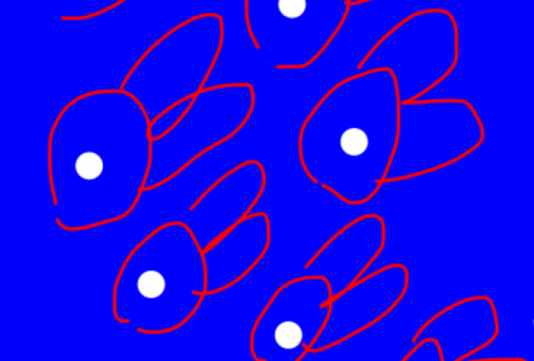 アール・ブリュット挑戦