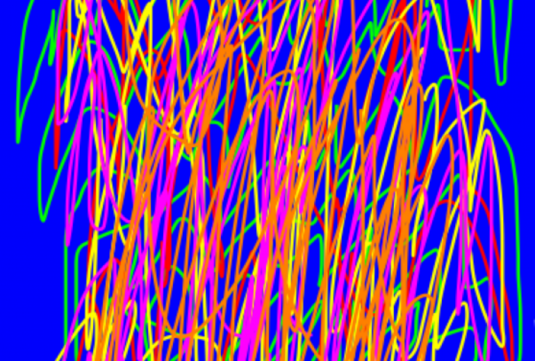 アール・ブリュット挑戦