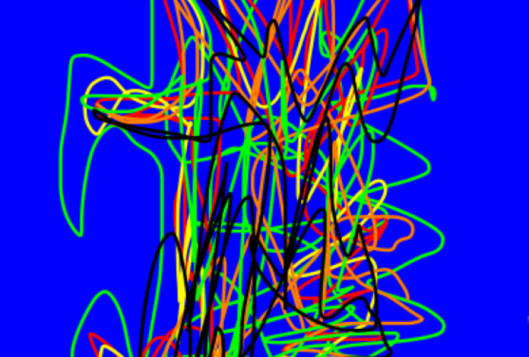 アール・ブリュット挑戦