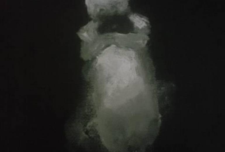 認知症のおばあちゃん、お孫さんの幻覚を抱き締める、たとえ幻覚でもそれは尊い