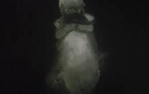 病気で亡くなった、お孫さんの幻覚を抱き締める、認知症のおばあちゃん - 真鍋哲地 