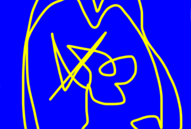 アール・ブリュット挑戦