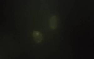 2つのドングリ 僕の大切な涙の母さんへ(母さんと僕、母さん人は幸せになるために生まれてくるよ)) - 真鍋哲地