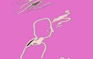 歯の矯正 - 万煉(まれん)