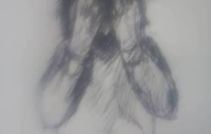 例えば貴女の容姿に障がいがあっても、僕は差別はしない - 真鍋哲地 