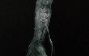 透析や点滴、苦しくても、僕はいつも遠くで貴方見てる、病気苦しむ人達、僕はいつも見てる - 真鍋哲地 