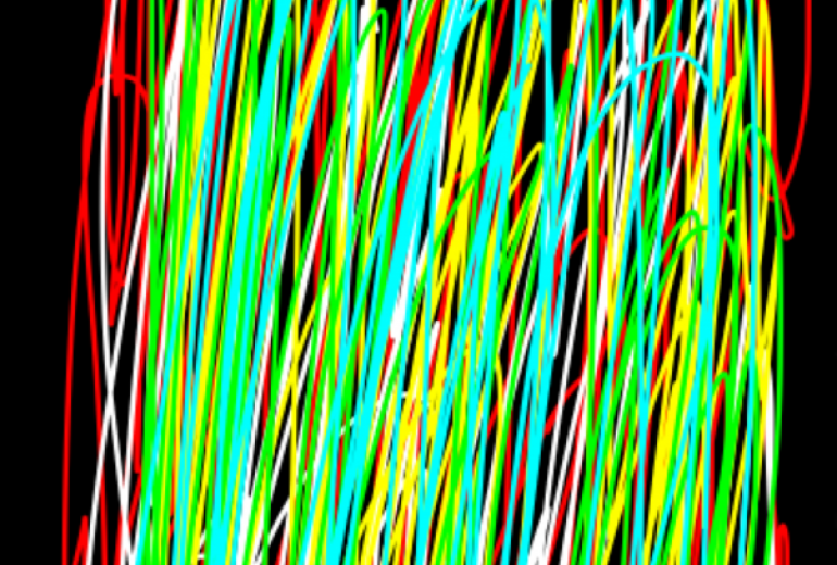 デジタル画