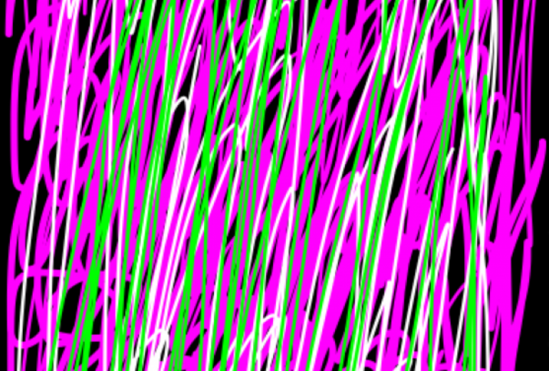 デジタル画