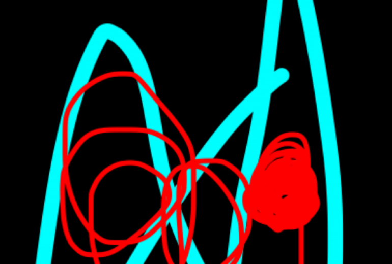デジタル画