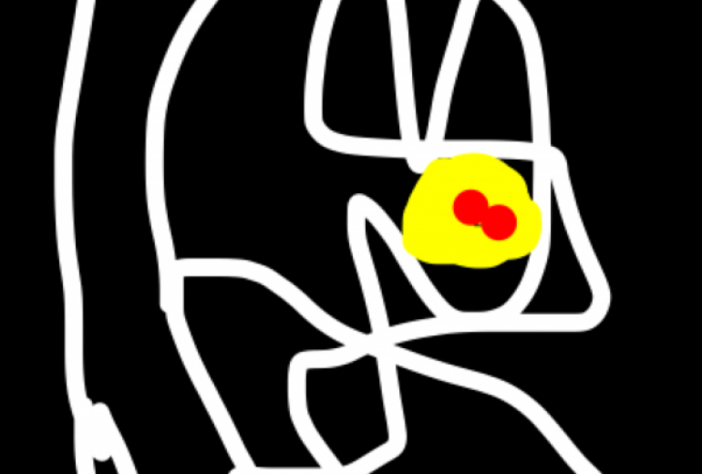 デジタル画